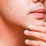 Как убрать раздражение после бритья у мужчин?